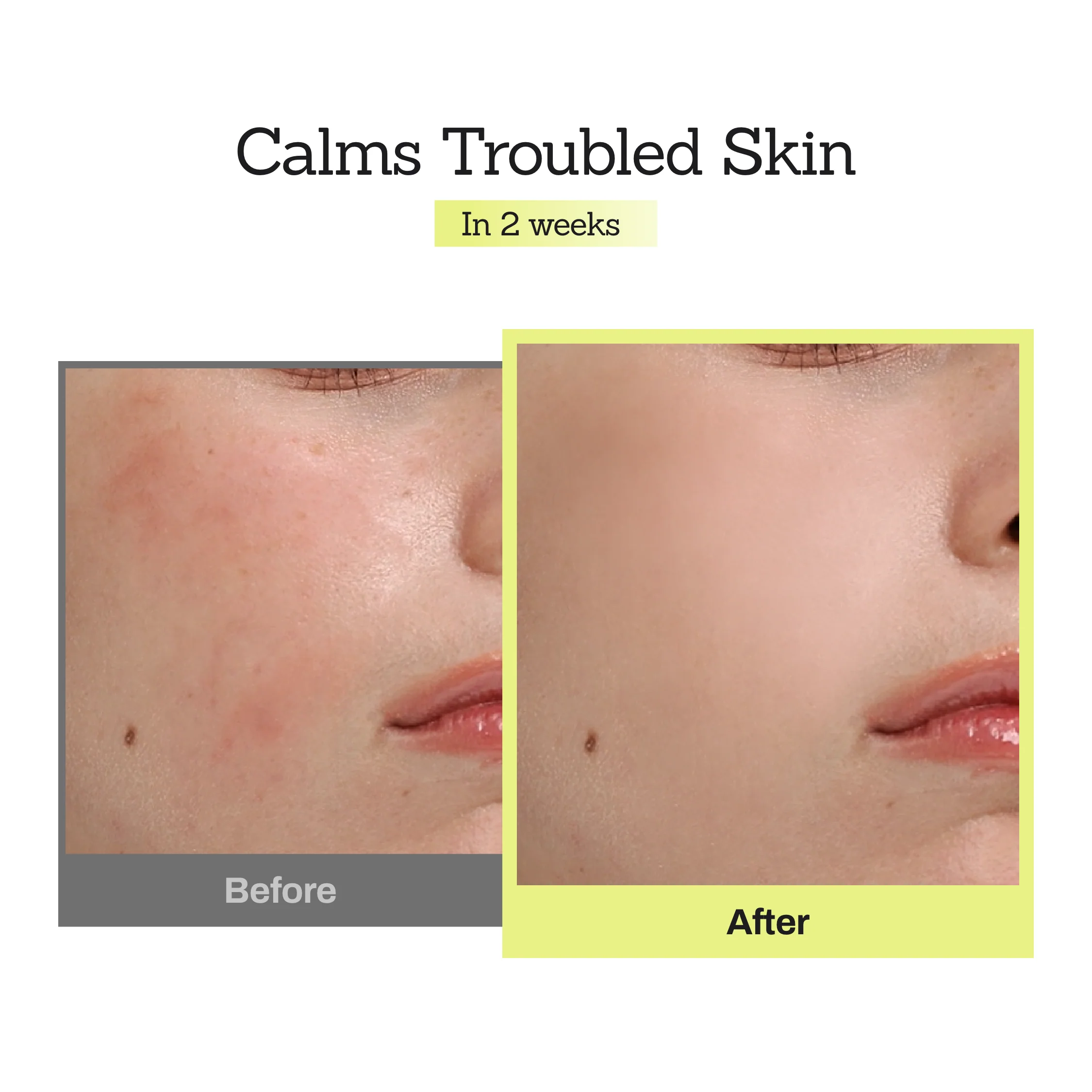Mugwort D-panthenol 30 Calming Serum - Image 5